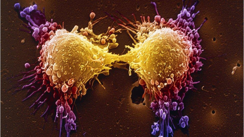 4 ubat Dnya Kanser Gn: Covid salgn, kanserle mcadeleyi nasl etkiledi?