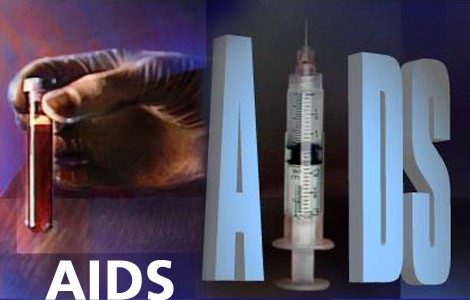AIDS Hastalnn rolojik nemi ve Aids Belirtileri