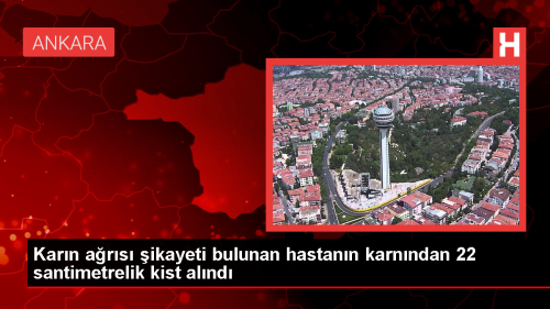 Ankara'da 22 Santimetrelik Kist Ameliyatla karld