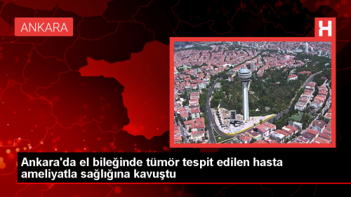 Ankara'da El Bileinde Tmr Tespit Edilen Hasta Cerrahi Mdahale ile Salna Kavutu