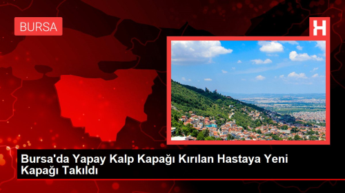 Bursa'da Yapay Kalp Kapa Krlan Hastaya Yeni Kapa Takld
