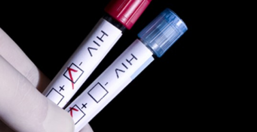 Fransa'da Evde AIDS Testi Sata kt