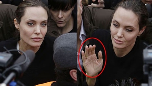 Kadnlar,  Angelina Jolie'nn olduu gibi ameliyat istiyor