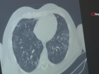 Kayseri'de influenza vakalar�nda art�� ya�an�yor