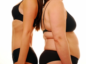 Liposuction Hangi Durumlarda Tercih Ediliyor?