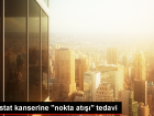 Prostat Kanseri HIFU Y�ntemiyle Ameliyats�z Tedavi Edilebiliyor