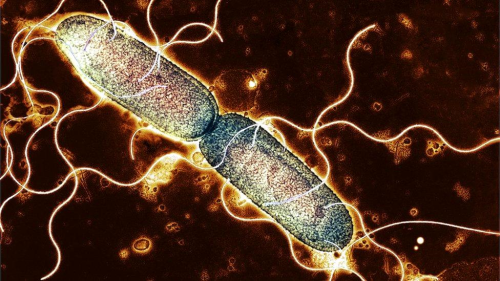 Salmonella nedir, nasl yaylyor, bakteri riski olan gdalar hangileri?