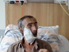 Trabzon haberleri: Trabzon'da, a�z�ndaki t�m�r nedeniyle su bile yutamayan hasta sa�l���na kavu�turuldu