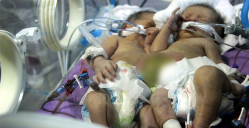 Trkiye'ye Snan Mlteci Ailenin Bebekleri Yapk Dodu
