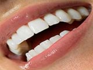 Yaz Aylarnn Yeni Trendi Dental Spa Yntemi