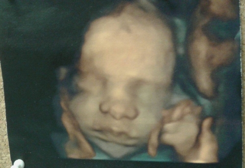 4 Boyutlu Ultrasonla Bebeğinizin Gülüşü Doğmadan Ekranda