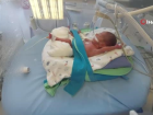 495 graml�k premat�re bebe�e k�k h�cre nakli: D�nyada ve T�rkiye'de say�l� nakil!