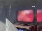 50 ya��ndaki kad�n�n safra kesesinden 2 bin tane ta� ��kt�