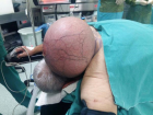 50 Y�ld�r Ensesinde Ta��d��� Kitle, Doktorlar� Bile Hayrete D���rd�