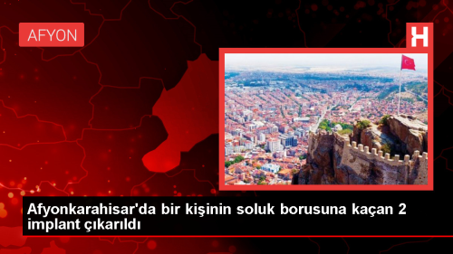 Afyonkarahisar'da Di Tedavisi Srasnda Soluk Borusuna Kaan mplantlar Baaryla Alnd