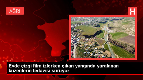 Ar'da izgi film izlerken kan yangnda yaralanan kuzenlerin tedavisi sryor