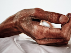 AIDS Her Y�l Ortalama 1 Milyon Can Al�yor