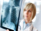 Akci�erlerin Yak�n Dostu; Fiberoptik Bronkoskopi!