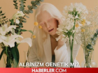 Albinizm nedir, genetik mi? Albino ne demek? Albinizm hastal���n�n tedavisi var m�?