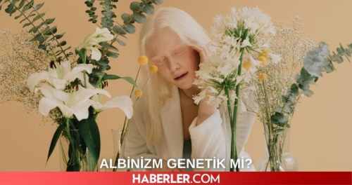 Albinizm nedir, genetik mi? Albino ne demek? Albinizm hastalnn tedavisi var m?