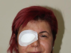 Alerji olan kad�n�n derisi d�k�ld�, sa� g�z� g�rme kayb� ya�ad�