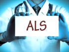 ALS hastal��� nedir? ALS hastal��� belirtileri nelerdir? ALS tedavisi nas�l olur? ALS kal�tsal bir hastal�k m�d�r? 21 Haziran D�nya ALS Hastal��� G�n�