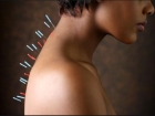 Alternatif T�p Uygulamalar�na Y�netmelik Geliyor