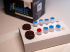 Alzheimer riskini �l�en 'NishK�T' PCR tan� kiti Sa�l�k Bakanl��� kullan�m onay� ald�