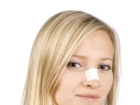 Ameliyats�z Burun Esteti�i
