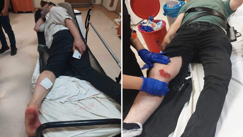 Ankara'da babo sokak kpeklerinin saldrd 2 kii, hastanelik oldu