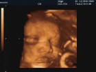 Anne Karn�nda G�len Bebek