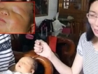 Anne Karn�nda Sorun G�r�lmeyen Bebek, G�zleri Olmadan D�nyaya Geldi
