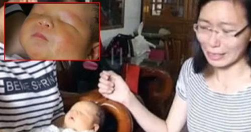 Anne Karnnda Sorun Grlmeyen Bebek, Gzleri Olmadan Dnyaya Geldi