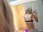 Anoreksik Kad�n, Pop�ler Olay�m Diye Az Kals�n �l�yordu