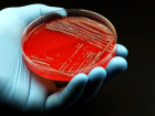 Antibiyotikler ba��rsaktaki faydal� bakterileri yok ediyor mu?