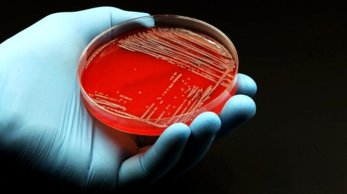 Antibiyotikler barsaktaki faydal bakterileri yok ediyor mu?