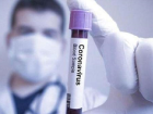 Ara�t�rma: Midkin protein seviyesi koronavir�s�n yeni belirtisi olabilir