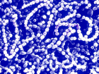 Ara�t�rma: Sepsis hastal��� d�nyada her be� �l�mden birine neden ouyor