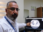 A��s�z hastalar�n akci�er tomografisini payla�arak uyard�
