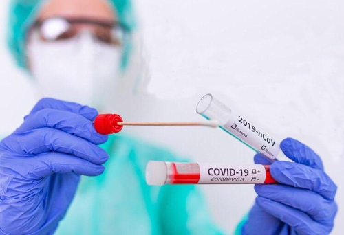 Aszlar, PCR test laboratuvarlarnn ykn artryor