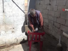 Aya�� kesilen T�rk vatanda��na Suriyeli doktordan �cretsiz protez tak�ld�