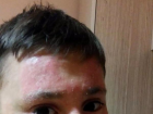 Bal�k derisi hastas� Kayra'n�n yard�m ���l���!