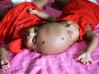 Banglade�'de Kafas�ndan Yap���k �kizler D�nyaya Geldi