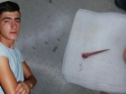 Batan Diken Nedeniyle Az Kals�n Kolunu Kaybediyordu