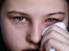 Beh�et Hastal��� Klinik �al��mas� T�rkiye'den �ki Uzmana Emanet