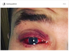 Berkay sa�l�k problemi 