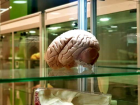 Beyin implantlar� haf�zay� y�zde 20 artt�r�yor