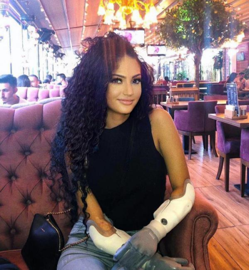 Beyza, ift kol nakli iin Almanya'dan Trkiye'ye geldi