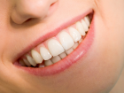 Bonding Uygulamas�yla Etkileyici Bir G�r�n�me Kavu�un