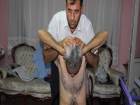 B�yle F�t�k Tedavisi G�r�lmedi